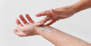 How to treat eczema flare-ups: a practical guide